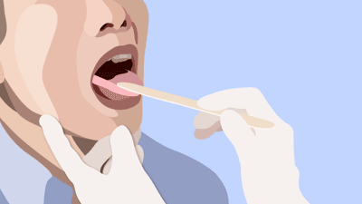 2021/03/open_mouth-860x478-1.png