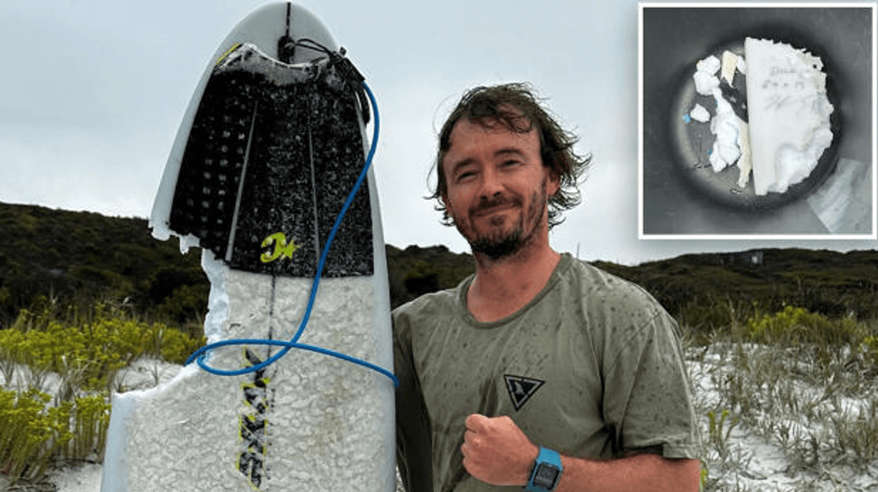 Ja se si një sërfist australian i mbijetoi sulmit të peshkaqenit