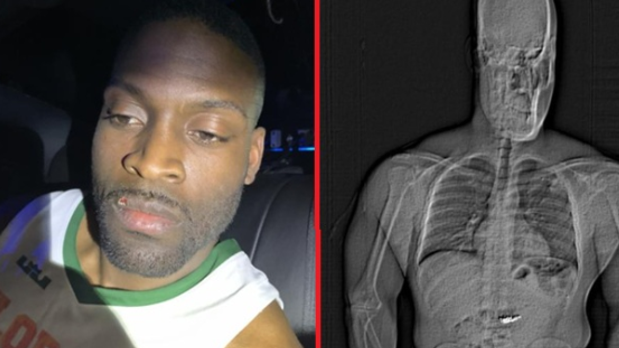 Burri vjedh dhe më pas i gëlltit bizhuteritë me vlerë mbi 700 mijë euro