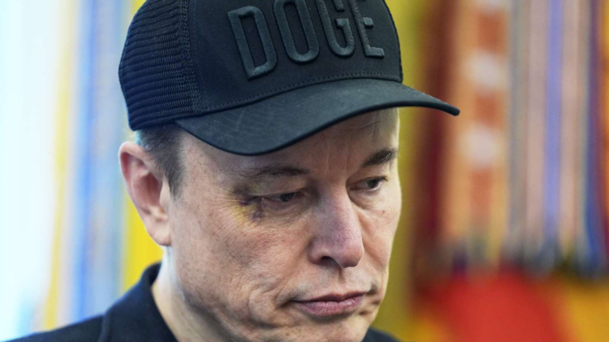 Musk shfaqet me sy të mavijosur: Djali më goditi me grusht