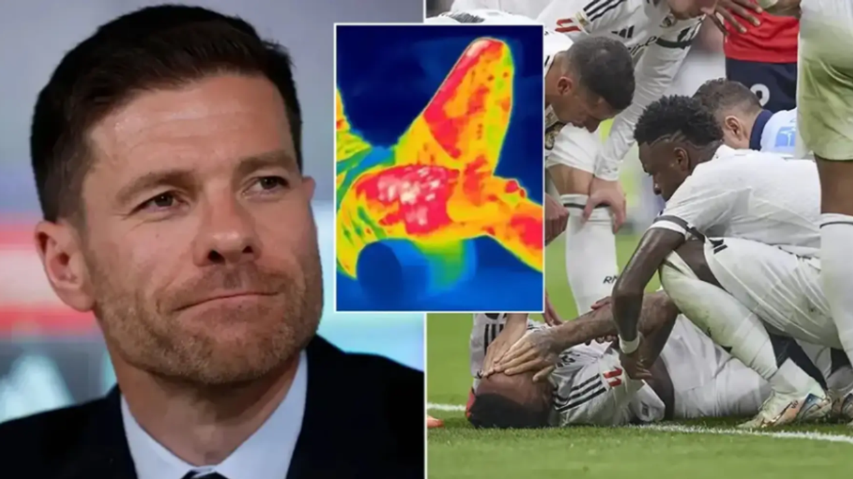 Xabi Alonso gjen mënyrën perfekte për të parashikuar lëndimet te Real Madridi duke përdorur teknologjinë më të fundit