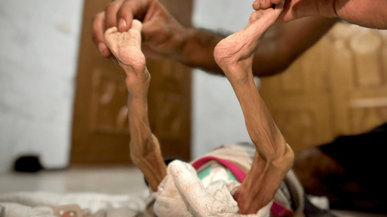 Vdes nga uria foshnja 6-muajshe palestineze - nëna zemërthyer publikon pamjet 'asht e lëkur' të së bijës