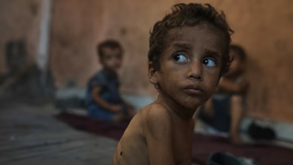 Britania do të evakuojë fëmijët palestinezë në gjendje kritike dhe të plagosur