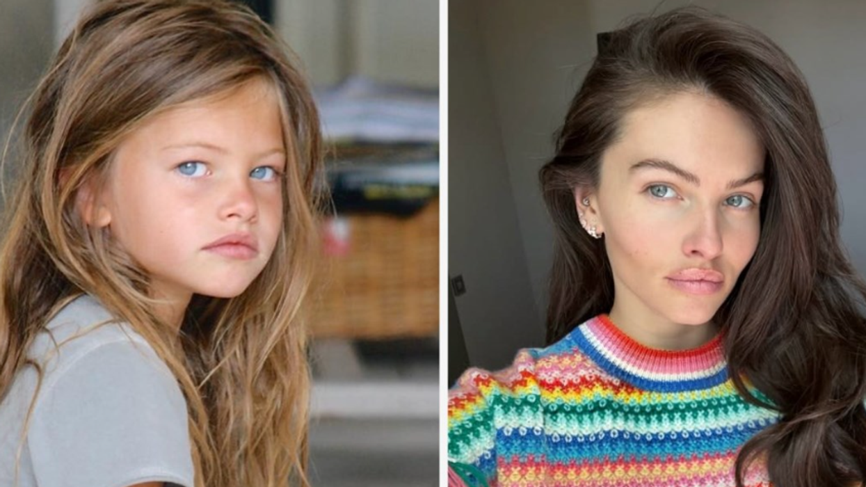 Dikur vajza më e bukur në botë, tani iu përgjigjet akuzave rreth ndërhyrjeve kirurgjike