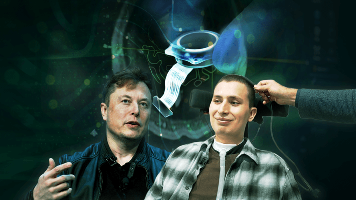 Rrëfimi i të riut që gjeti shpresë përmes çipit të trurit Neuralink: Ndihem magjik