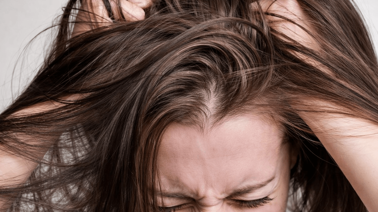 Nëse ju kruhet skalpi, flokët nuk rriten: Ja çfarë duhet të bëni së pari