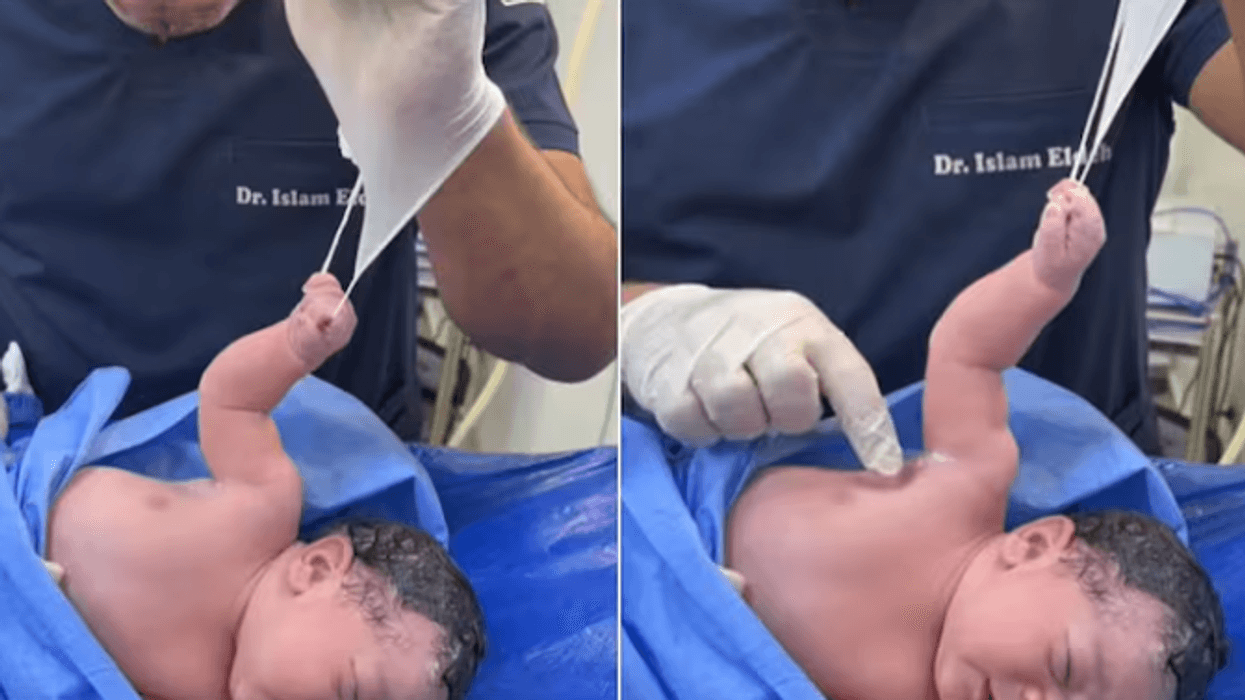 Video virale, i porsalinduri nuk i lëshon dorën mjekut në minutat e para të jetës