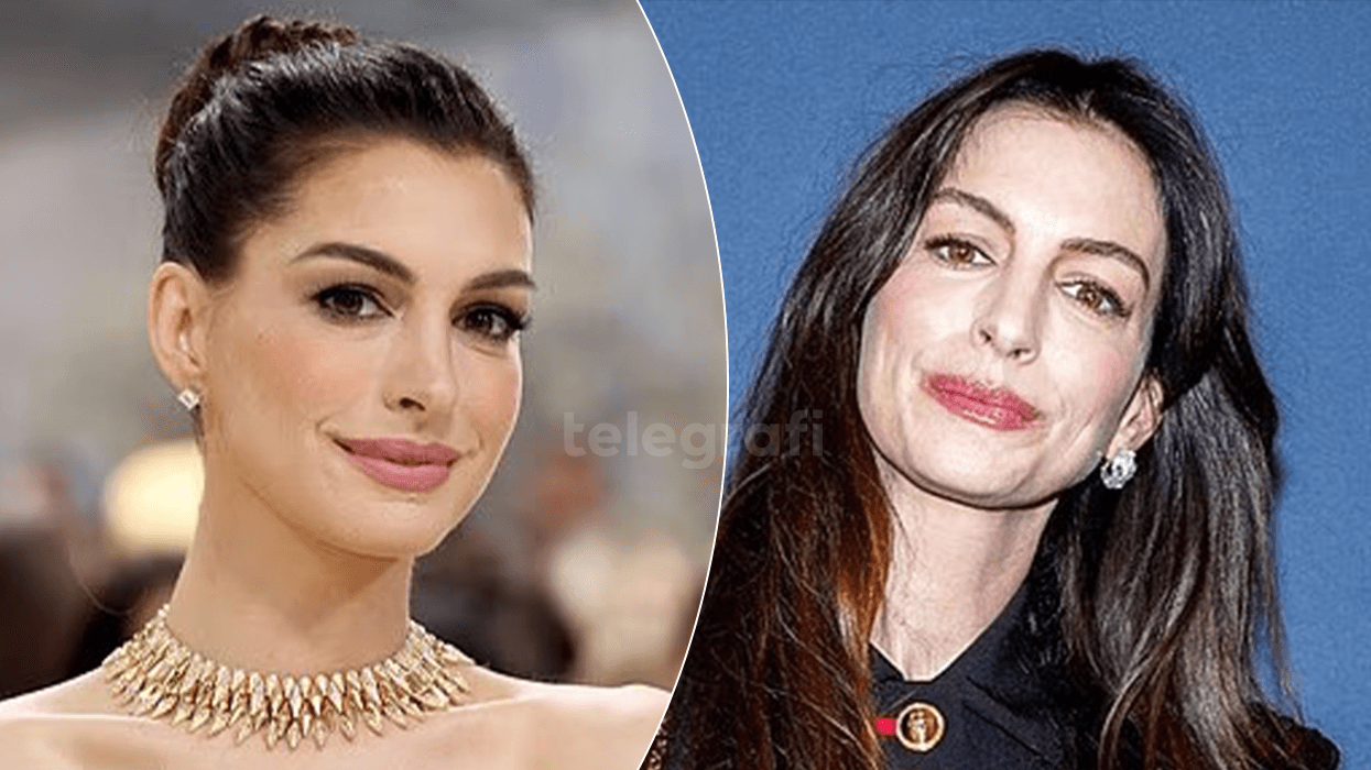 Anne Hathaway mohon ndërhyrjet estetike: Pamja ime ndryshoi vetëm falë stilimit të flokëve