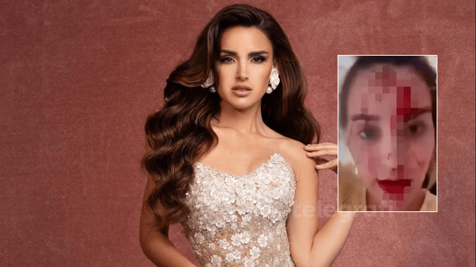 Miss Venezuela 2025 sulmohet në Kanë, stilisti i saj arrestohet në vendngjarje