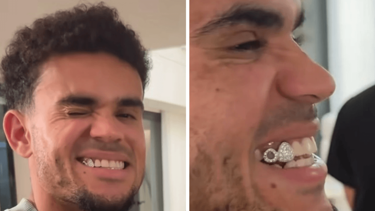 Ylli i Bayernit vendos 29 diamante në dy dhëmbë Ylli i Bayernit vendos 29 diamante në dy dhëmbë