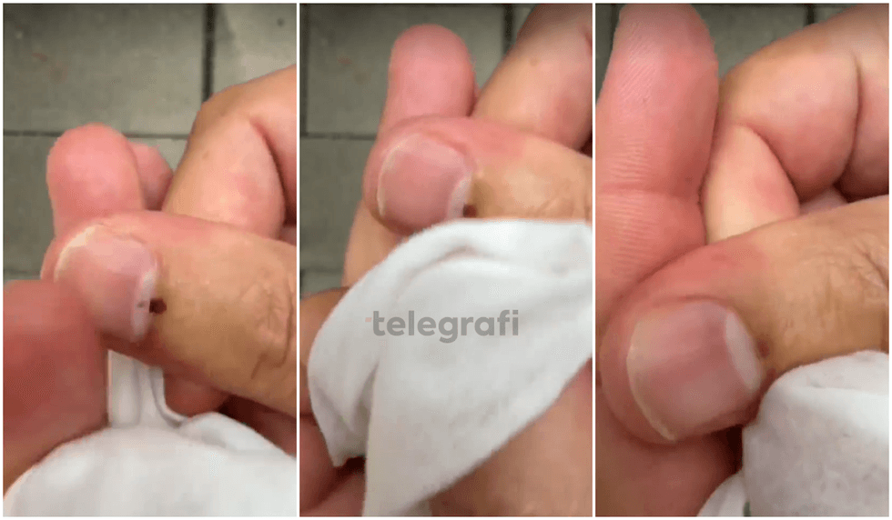 Qytetari ngre shqetësime për markerin zgjedhor, pretendon se