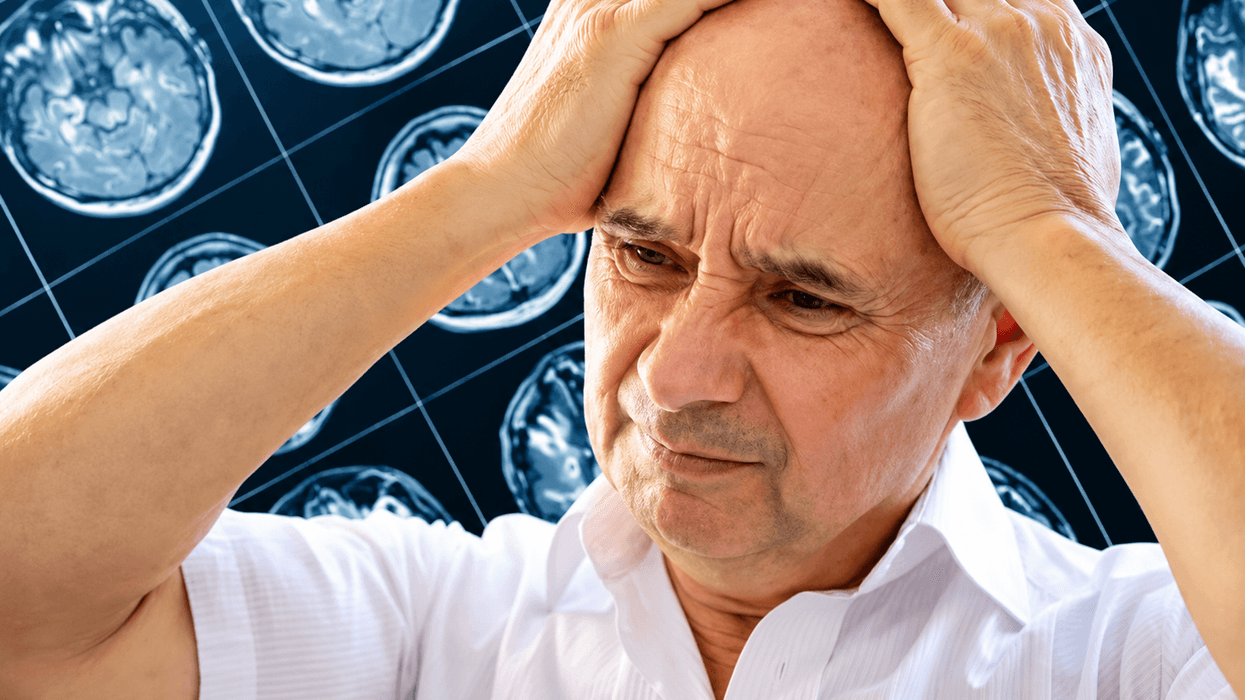 Mjekët dyshuan për tumor në tru, por MRI zbuloi parazitë: Rasti i rrallë që befasoi specialistët