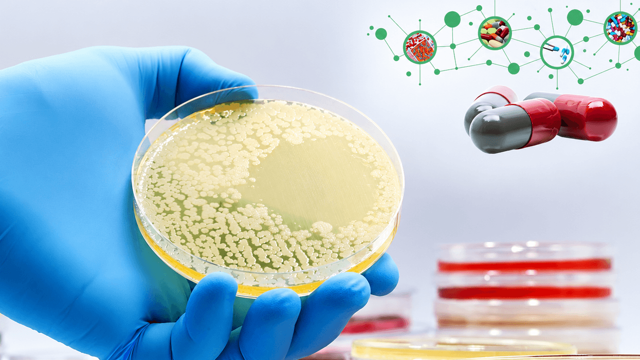 Pse jo çdo antibiotik është zgjedhja e duhur: Çfarë tregon antibiogrami dhe pse është kaq i rëndësishëm Pse jo çdo antibiotik është zgjedhja e duhur: Çfarë tregon antibiogrami dhe pse është kaq i rëndësishëm