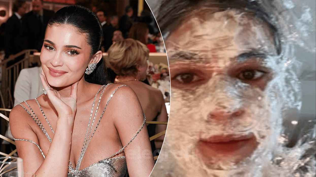“Vajzë e çmendur”, Kylie Jenner habit fansat me pamjen gjatë trajtimit të fytyrës