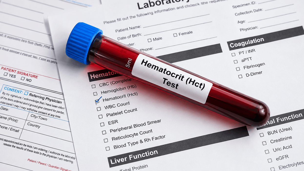 Hematokriti i lartë apo i ulët? Ja çfarë mund të zbulojë ky test i zakonshëm Hematokriti i lartë apo i ulët? Ja çfarë mund të zbulojë ky test i zakonshëm