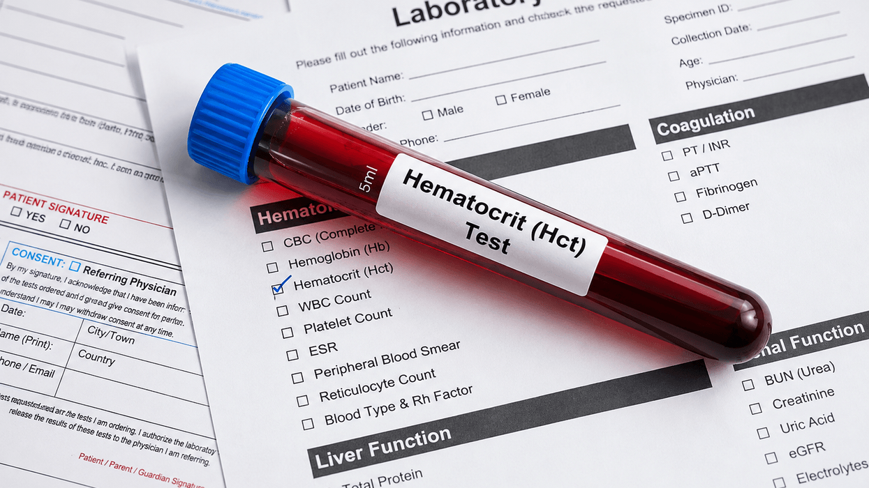 Hematokriti i lartë apo i ulët? Ja çfarë mund të zbulojë ky test i zakonshëm