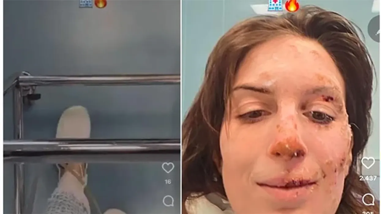 Rrëfimi i gruas që i mbijetoi zjarrit në Zvicër: Nuk e di si shpëtova Rrëfimi i gruas që i mbijetoi zjarrit në Zvicër: Nuk e di si shpëtova