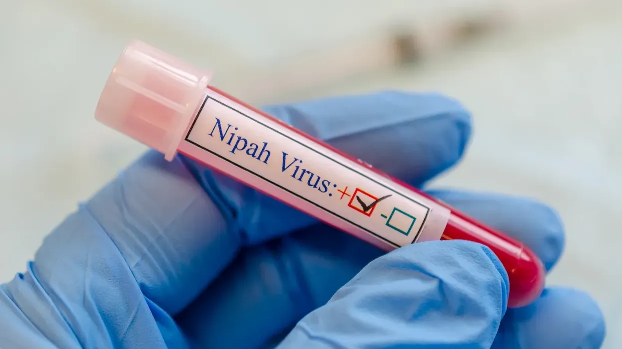 India lufton shpërthimin vdekjeprurës të virusit Nipah India lufton shpërthimin vdekjeprurës të virusit Nipah
