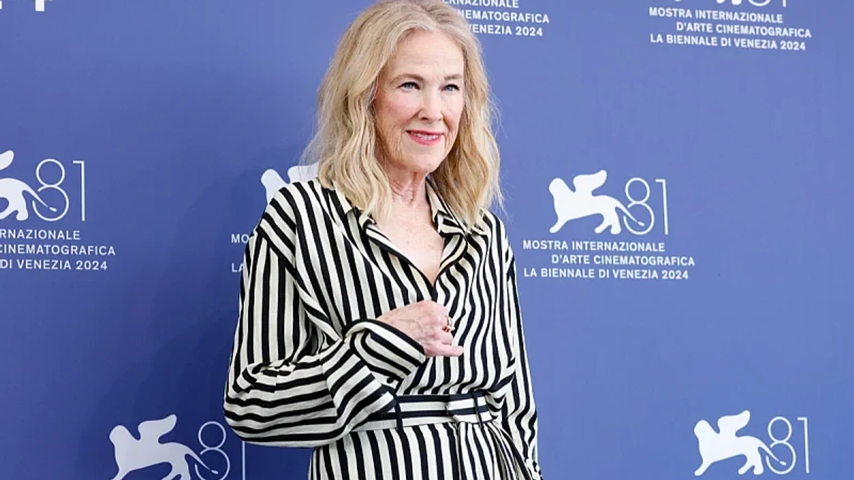 Ylli i “Home Alone”, Catherine O'Hara kishte një diagnozë të rrallë: Çfarë është situs inversus?