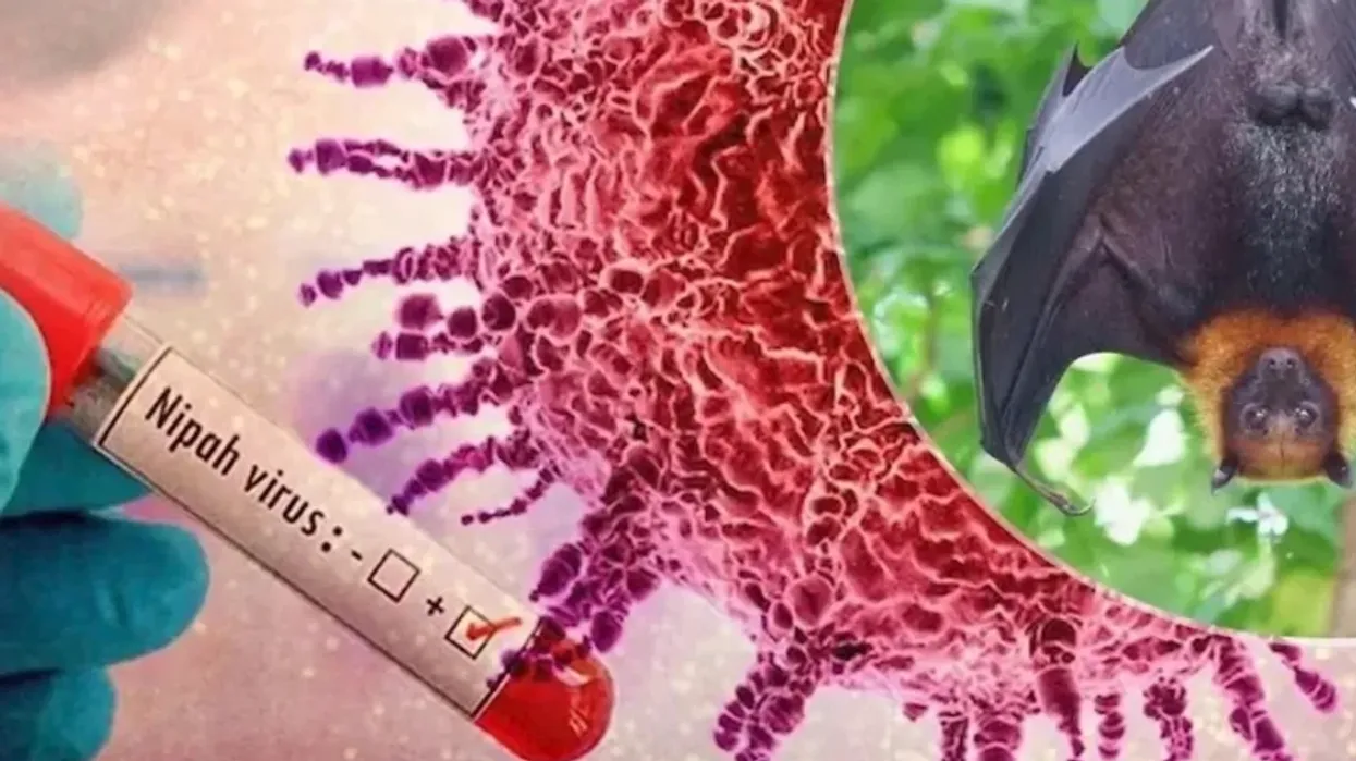 IKSHPK: Rreziku nga virusi Nipah për Kosovën është i ulët IKSHPK: Rreziku nga virusi Nipah për Kosovën është i ulët