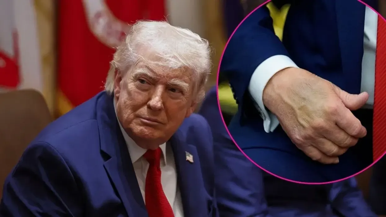 Çfarë zbuluan kontrollet e fundit mjekësore të Trumpit? Çfarë zbuluan kontrollet e fundit mjekësore të Trumpit?