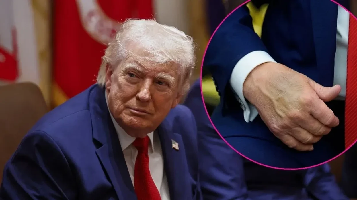 Çfarë zbuluan kontrollet e fundit mjekësore të Trumpit?