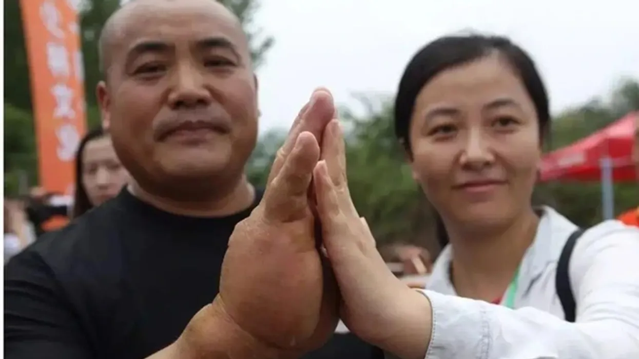 Mjeshtri i "kung-fu" ka pëllëmbë 7 cm të trashë pas 20 vitesh stërvitje ekstreme Mjeshtri i