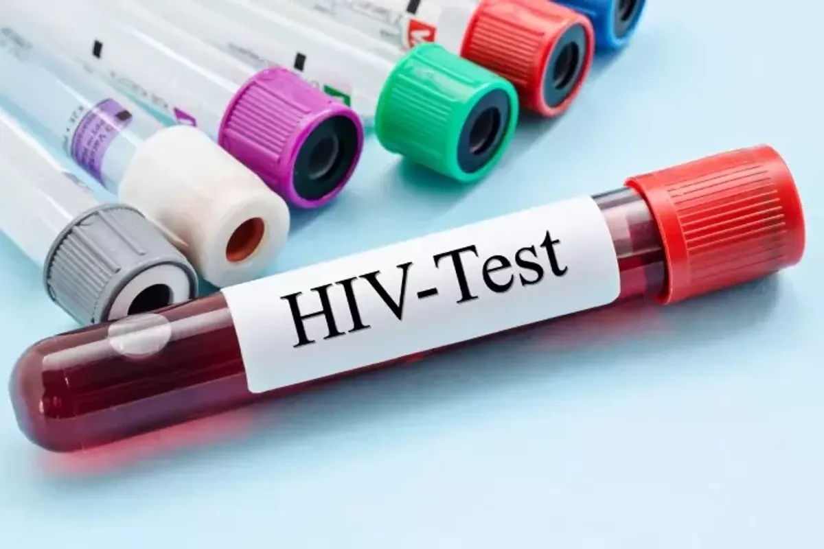 Dhjetë raste të reja me HIV në muajt e fundit, dy viktima - rritet testimi vullnetar Dhjetë raste të reja me HIV në muajt e fundit, dy viktima - rritet testimi vullnetar