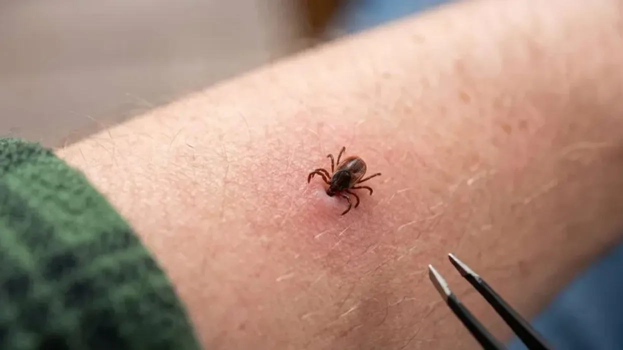 Rriqra nuk transmeton vetëm sëmundjen Lyme: Mund të shkaktojë alergji të rrezikshme ndaj mishit Rriqra nuk transmeton vetëm sëmundjen Lyme: Mund të shkaktojë alergji të rrezikshme ndaj mishit