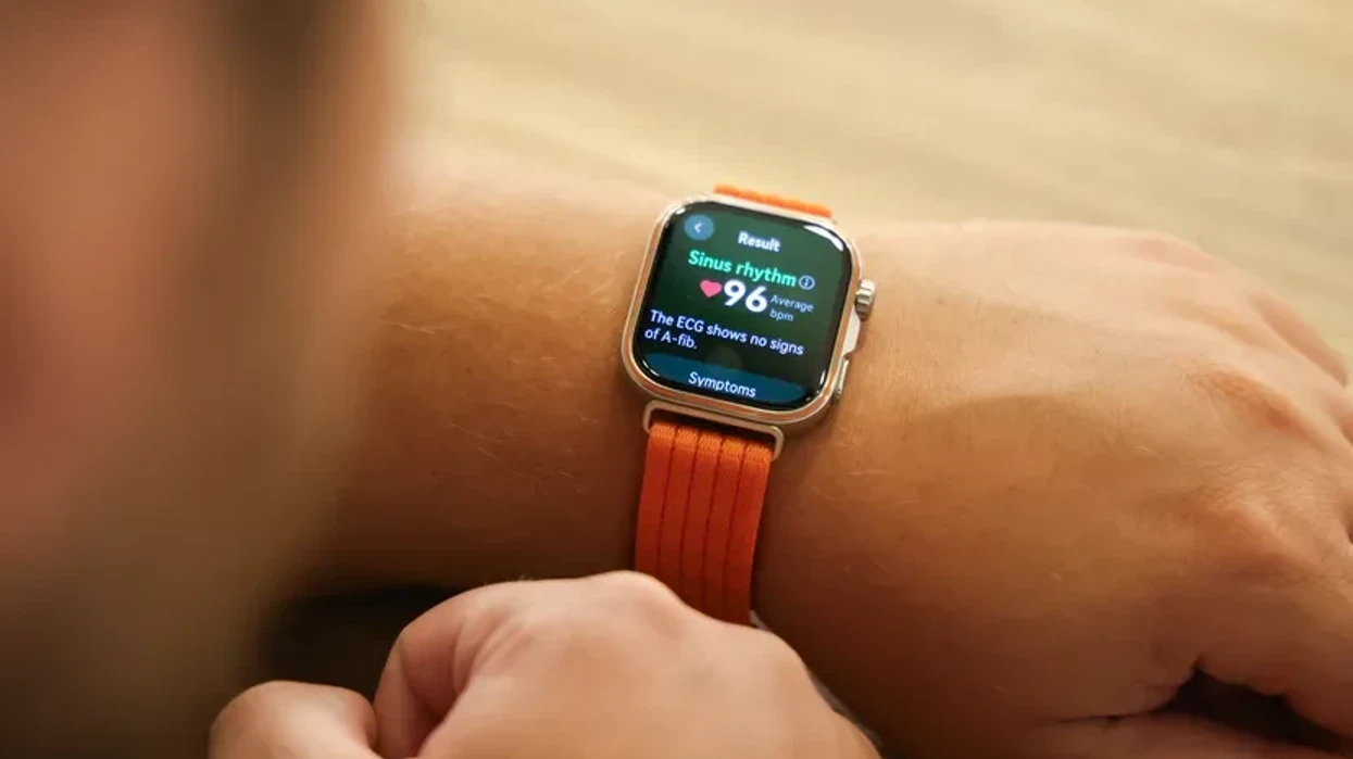 Orët inteligjente me EKG po ndryshojnë mënyrën e monitorimit të zemrës