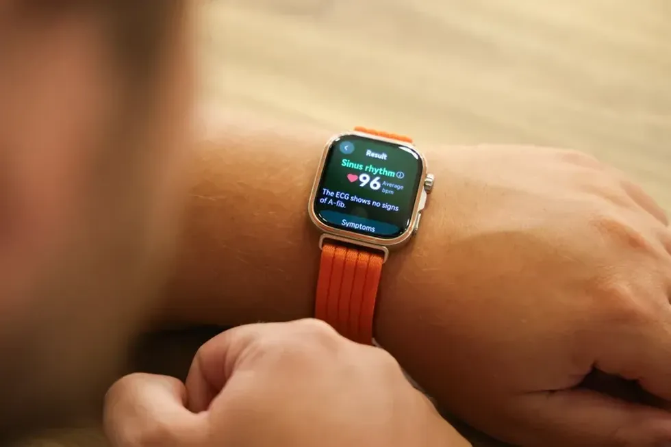 Orët inteligjente me EKG po ndryshojnë mënyrën e monitorimit të zemrës