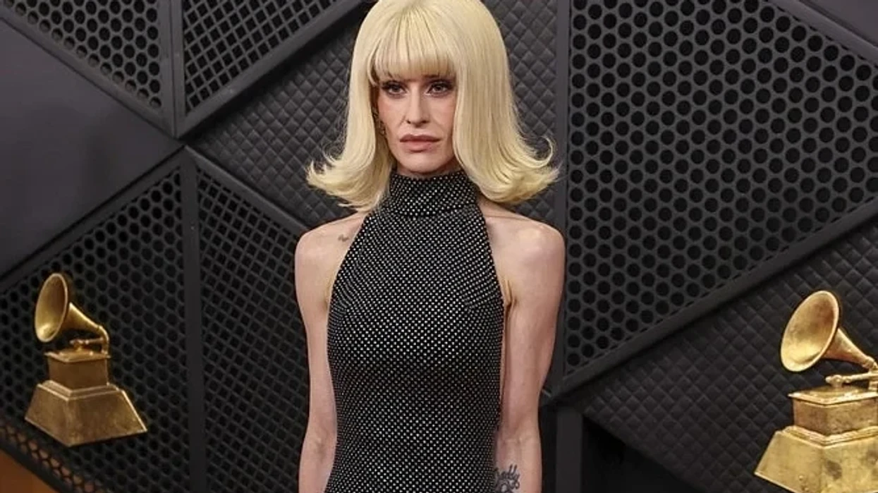 Kelly Osbourne flet për humbjen e peshës pas vdekjes së babait të saj: Mbaja paruke për të mbuluar fytyrën time
