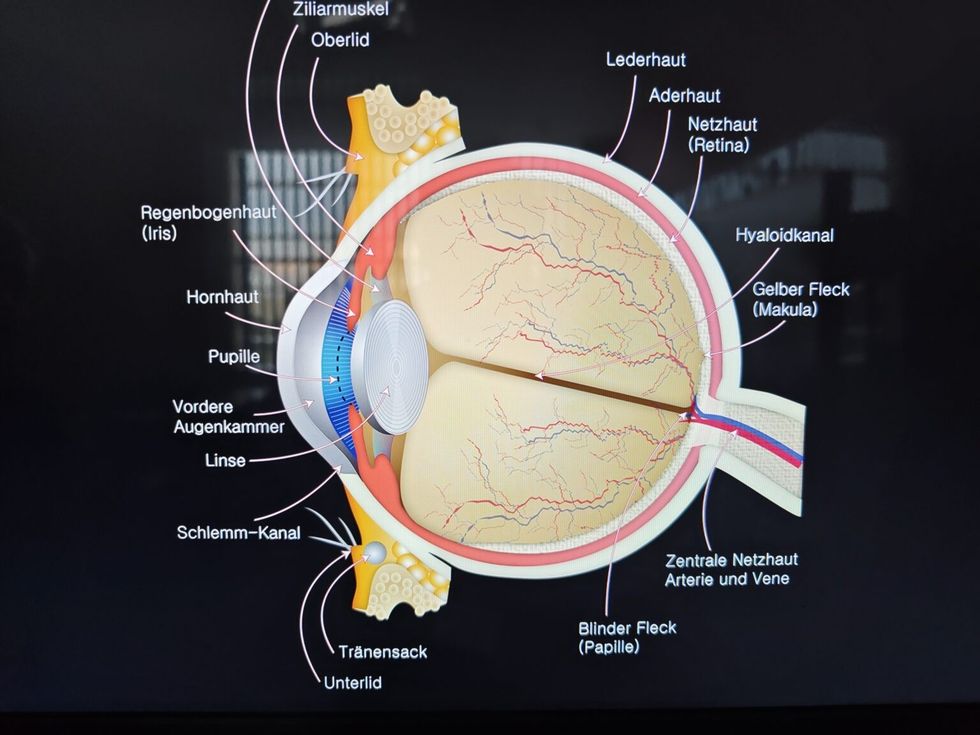 img 20240913 082929 1