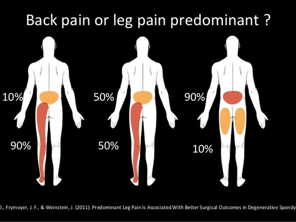 indications for surgery in adult spondylolisthesis 20 638