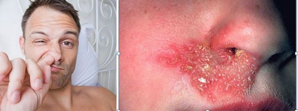 istock-76499275-medium