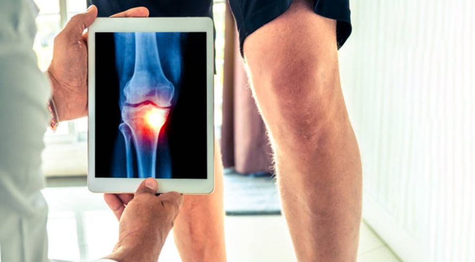 istockphoto 1072519440 1