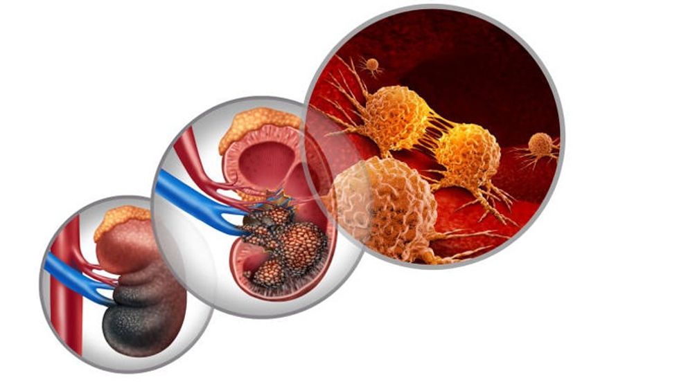 istockphoto 1171639634 1