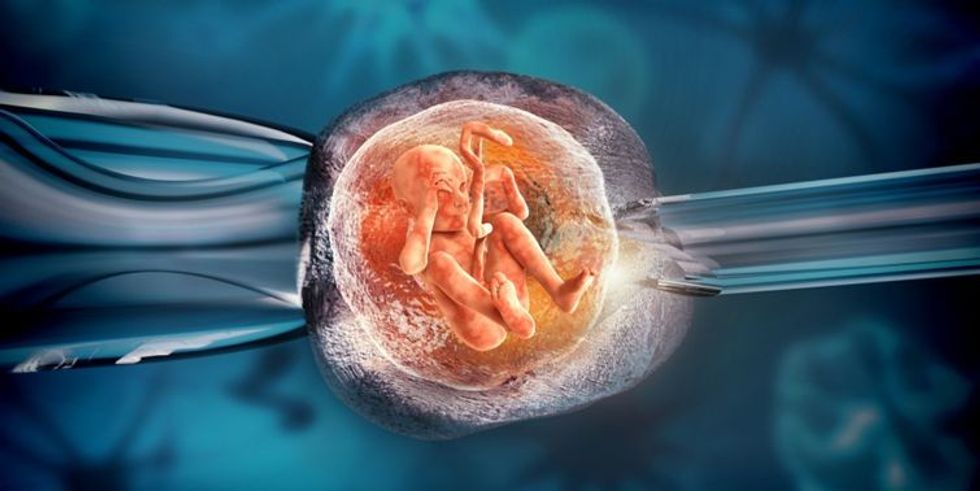 IVF Babies Conceived By In Virto Fertilization IVF Have Increased In Birth Weight