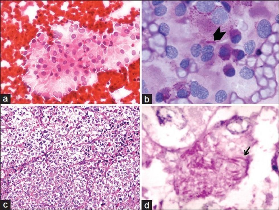 JCytol 2013 30 1 58 107517 f1(1)