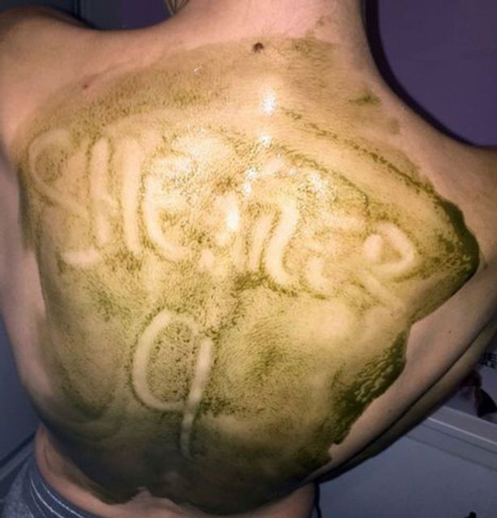 Kërkon nga i dashur të ja shpërndajë kremin në shpinë veprimi tij eshte qesharak foto 2