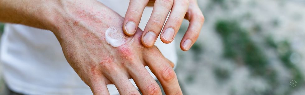 KFL Sjogrens v01 2 1