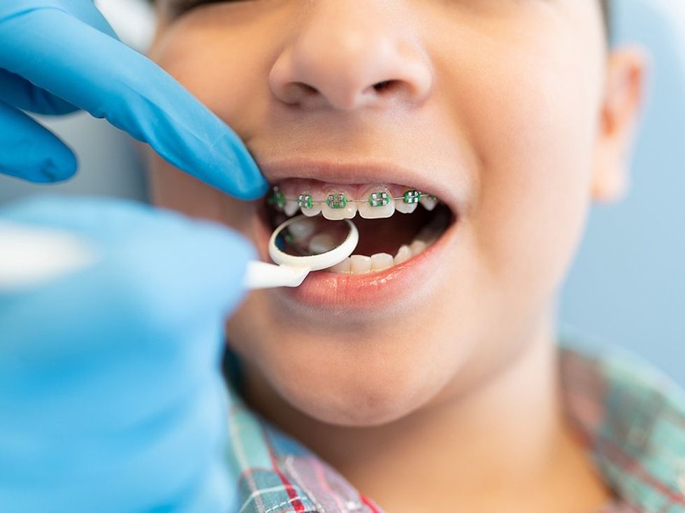 kid braces at dentist 376508296