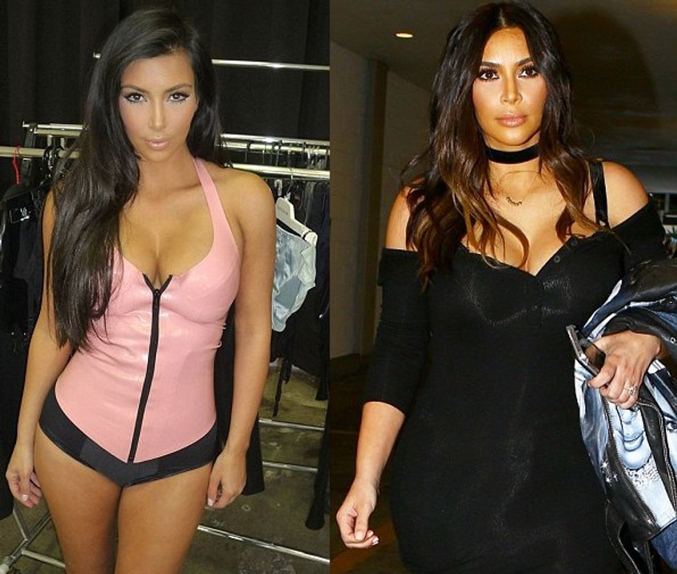 Kim1