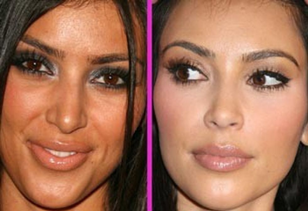 KimKardashianBeforeandafter