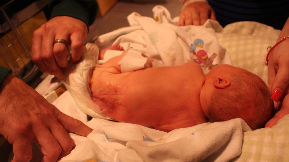 kingspinabifida1 scaled