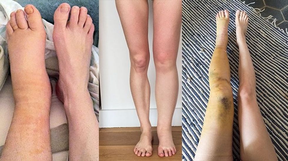 kolase kaki sarah jouanny 20180314 161306