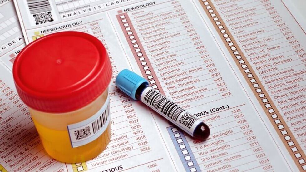 kreatinen i urea slika