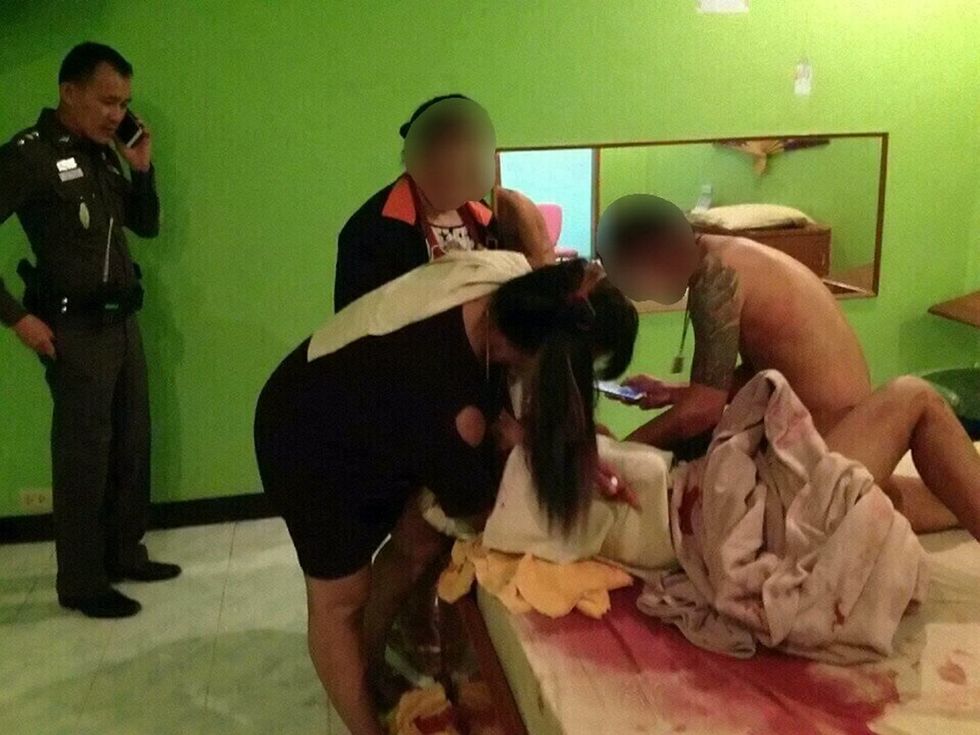 Kryente marrëdhënie e mbështetur për tavolinën e xhamit rrezohet keq dhe pret doren foto 3