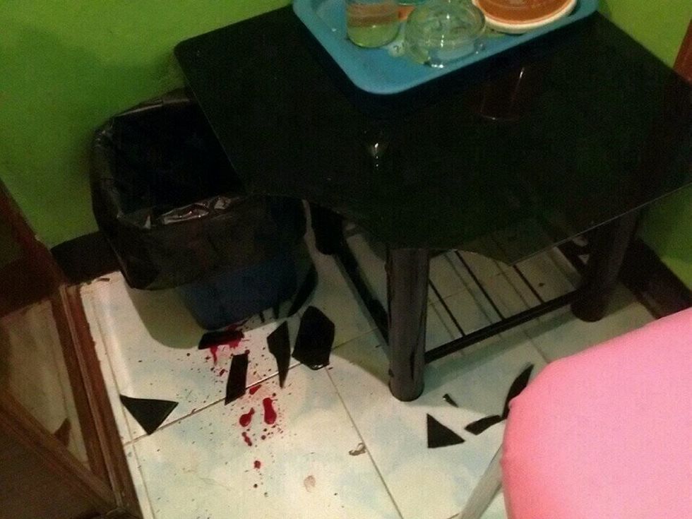 Kryente marrëdhënie e mbështetur për tavolinën e xhamit rrezohet keq dhe pret doren foto 4