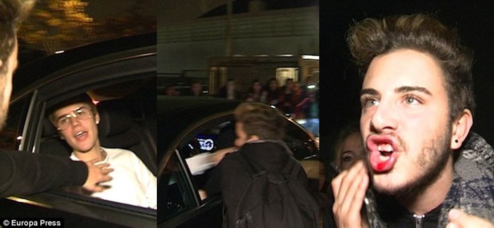 Ky ishte momenti i reagimit të Justin Bieber